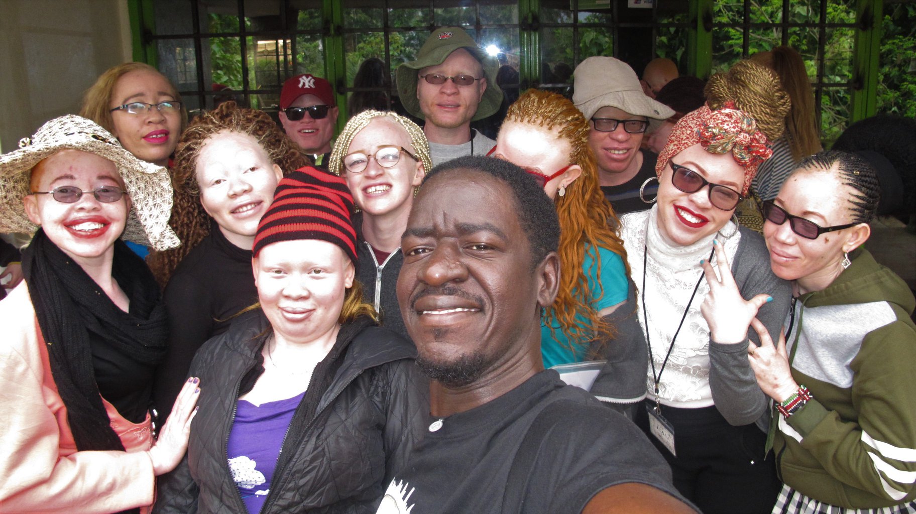 In the shadows of white pat Robert with some youth with albinism in meru kenya