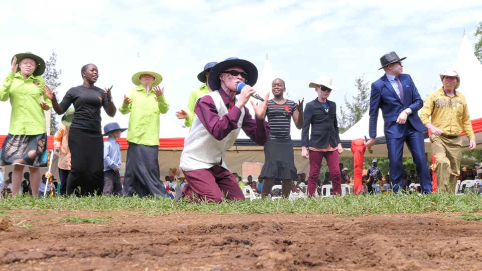 SNUPA Band using music to change perception on albinism (2)