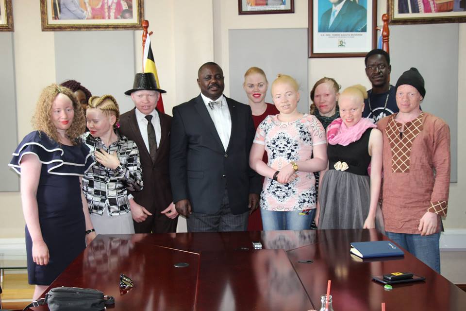 Team of youth with albinism pose for a picture with the deputy speaker of parliament before being flagged off for Mr and Miss Albinism East Africa.
